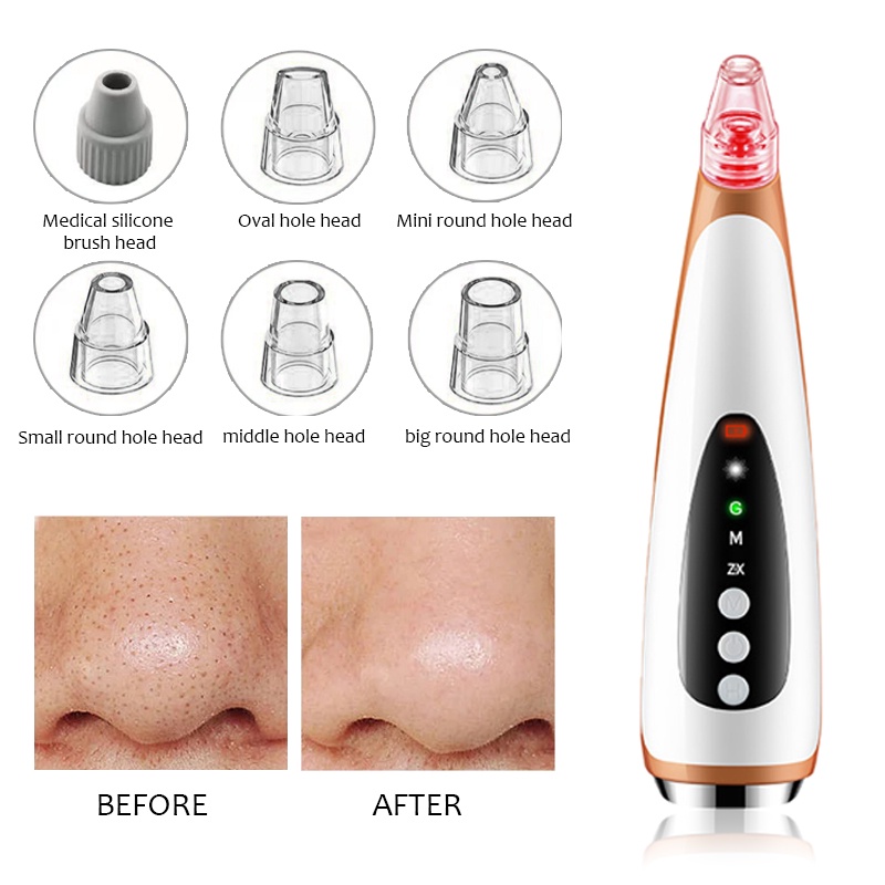 Máy hút mụn đầu đen SUAKE làm sạch lỗ chân lông chạy điện tiện dụng