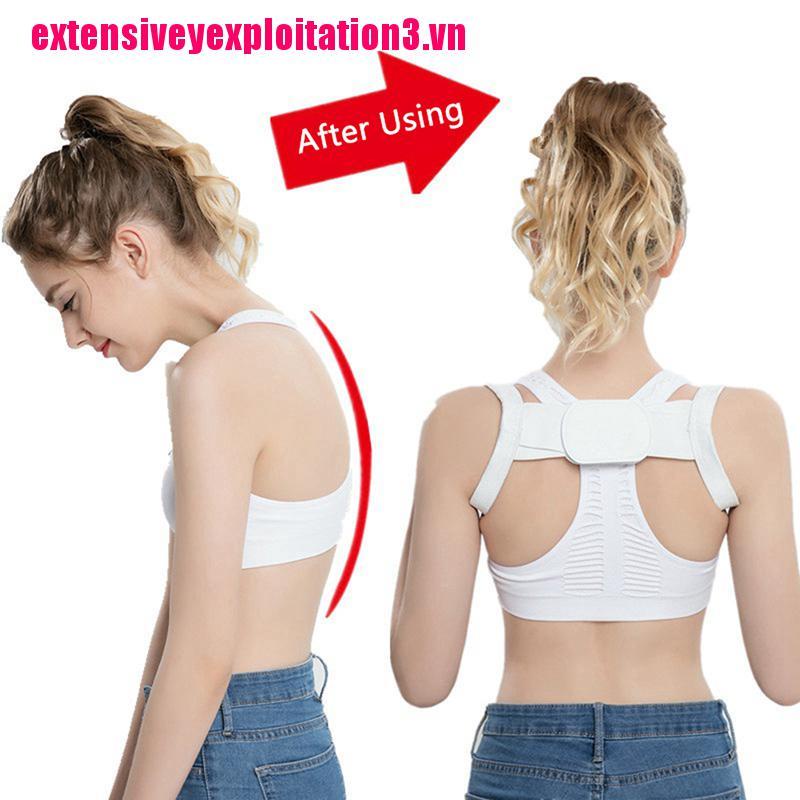 Dây Đai Đeo Lưng Điều Chỉnh Tư Thế Tiện Lợi