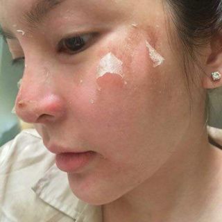 bộ mỹ phẩm thay da face tca usa