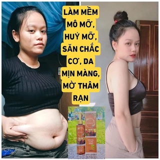CAO GỪNG HỦY MỠ, CAO GỪNG XOA BÓP ĐÔNG Y GIẢM MỠ