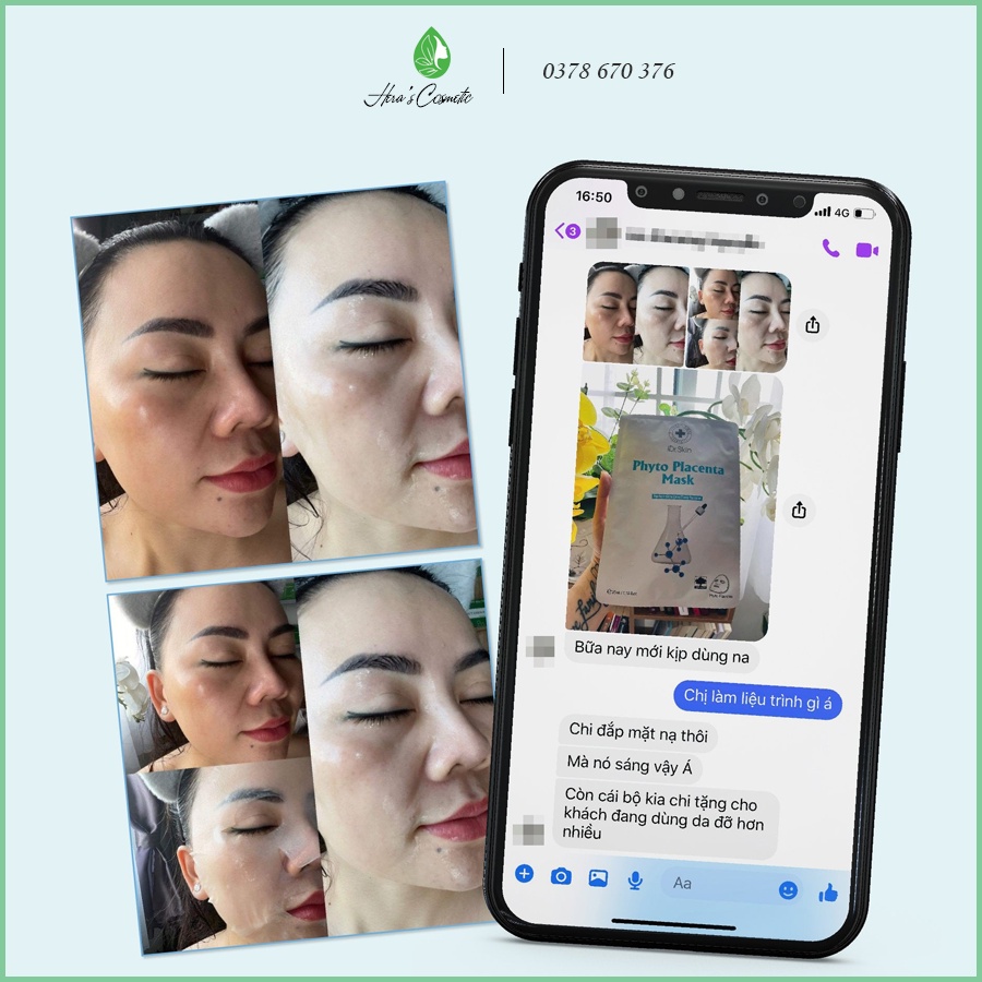 Mặt nạ nhau thai phục hồi da Idr Skin_ Idr Skin Phyto Placenta Mask giúp giảm sưng đỏ, phục hồi sau lăn kim, vi tảo...