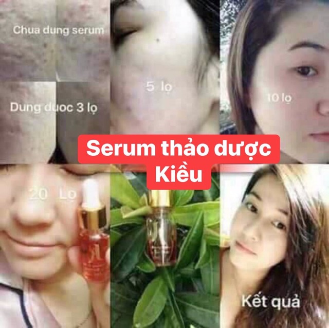 Serum Kiều beautyqueen_date mới 2020