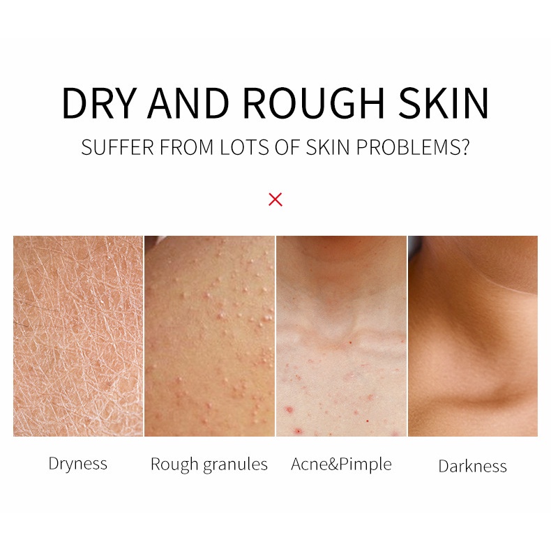 Tẩy Tế Bào Chết Bơ Hạt Mỡ Nhẹ Làm Sạch Da Mặt Và Cơ Thể Lỗ Chân Lông Sừng Bùn 1 Miếng | BigBuy360 - bigbuy360.vn