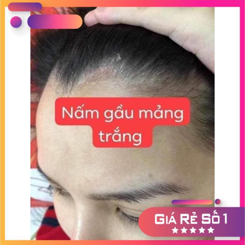 Kem bôi da kem bôi tổ đỉa ghẻ nước nấm ngứa các loại, thảo dược tự nhiên