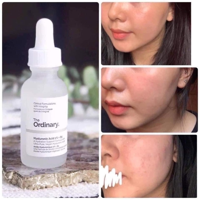 Bill US - Tinh chất dưỡng ẩm, phục hồi da The Ordinary HYALUNORIC 2% + B5 Serum