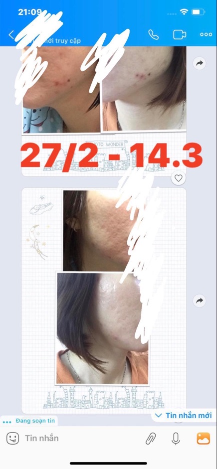 Tinh chất Niacid  đều màu da, phục hồi sẹo sau mụn