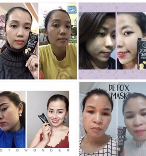 Thải độc da detox Mask