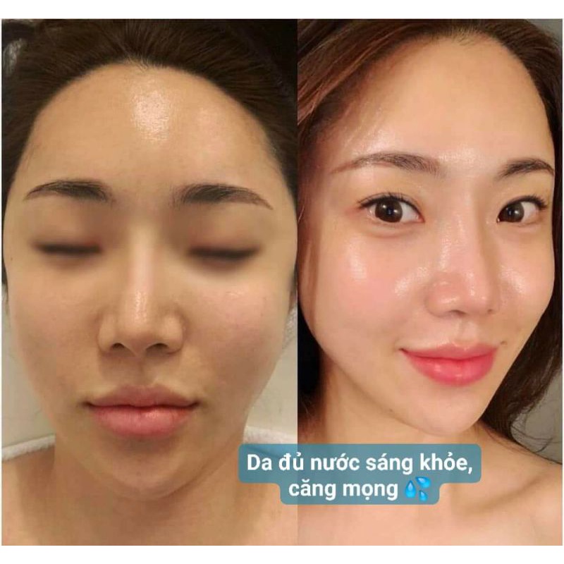 Gói kem cấp nước phục hồi da CNP Rx Blue Microlift Hydra Cream