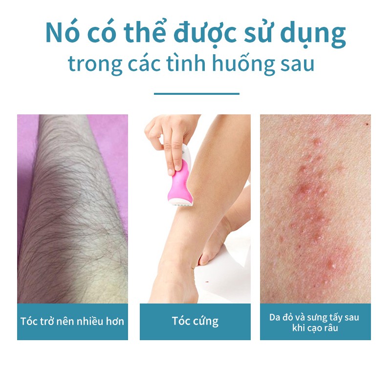 Kem RUOALL 30ML chiết xuất lô hội giúp dưỡng trắng da toàn cơ thể