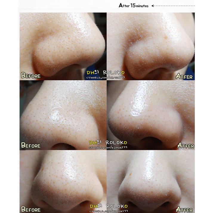 Thanh Lăn Giảm Mụn Đầu Đen Mamonde Pore Clean Blackhead Stick