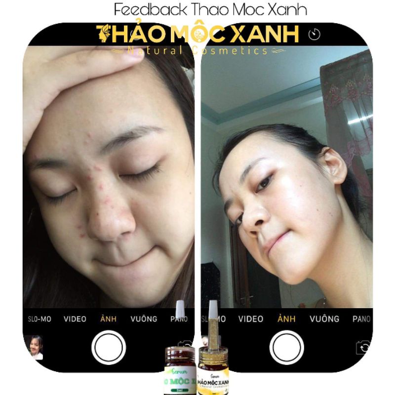 [FREESIP] Thảo Mộc Xanh Trắng Da X5 Cấp Ẩm ,Dưỡng da Căng Bóng | BigBuy360 - bigbuy360.vn