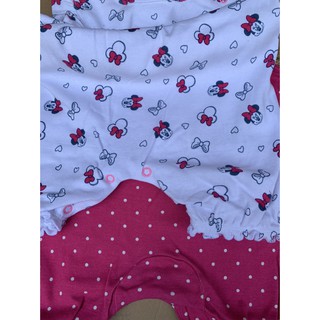 Sét 2 body đùi mickey cho bé gái