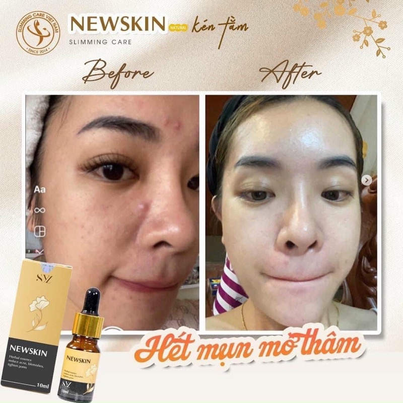 Tinh chất serum kén tằm Newskin Simming Sylic ngăn ngừa mụn chuyên sâu