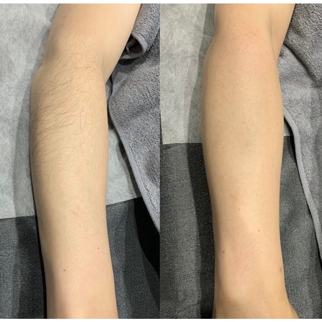 Sáp Wax Lông Lạnh Mật Ong Horshion Hàn Quốc 750ml