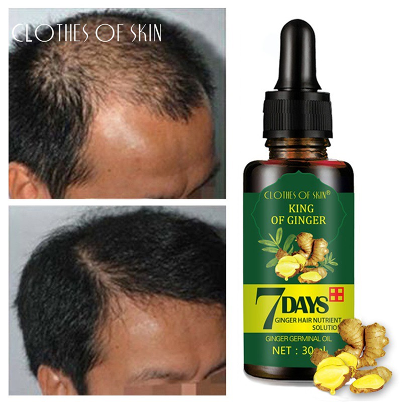 [Hàng mới về] Serum dưỡng kích thích mọc tóc tinh chất gừng tự nhiên dưỡng chân tóc khỏe mạnh