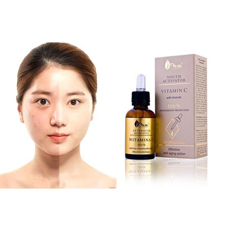 Serum Vitamin C Ava youth Activator dưỡng trắng da mờ thâm nám tàn nhang