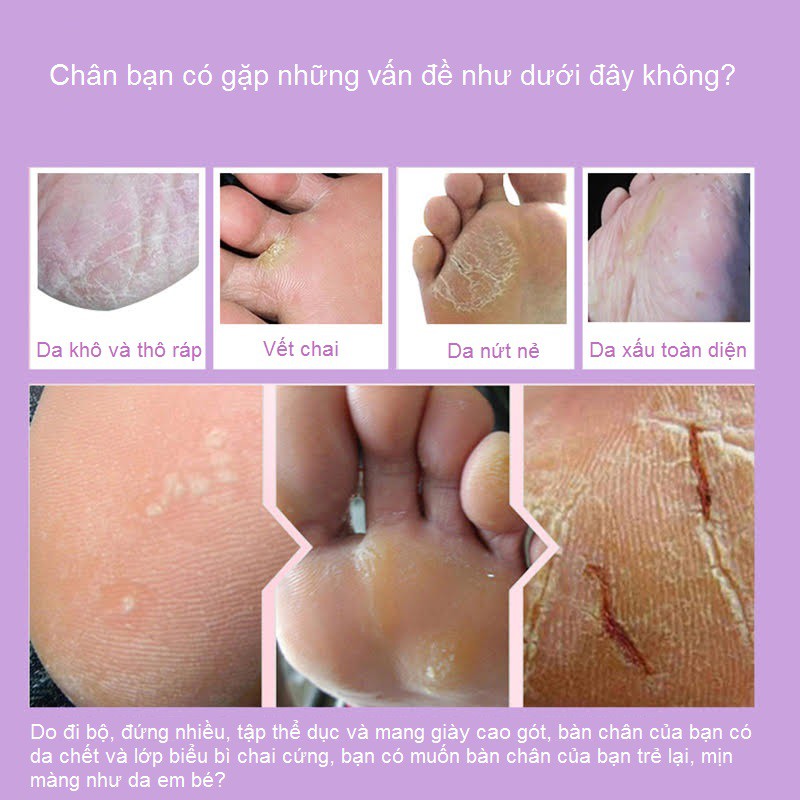 Mặt nạ lavender ủ tẩy tế bào chết bàn chân, tẩy vết chai, nứt gót chân, dưỡng da chân