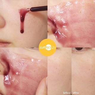 Tinh Chất Peel Da SO'NATURAL RED PEEL 35ML