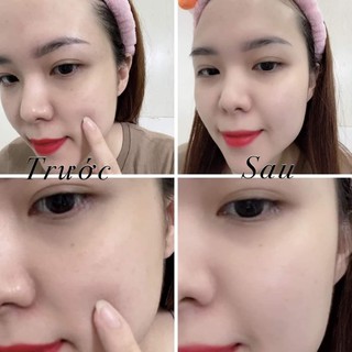 Men Ủ Trắng Mặt Dr Cell