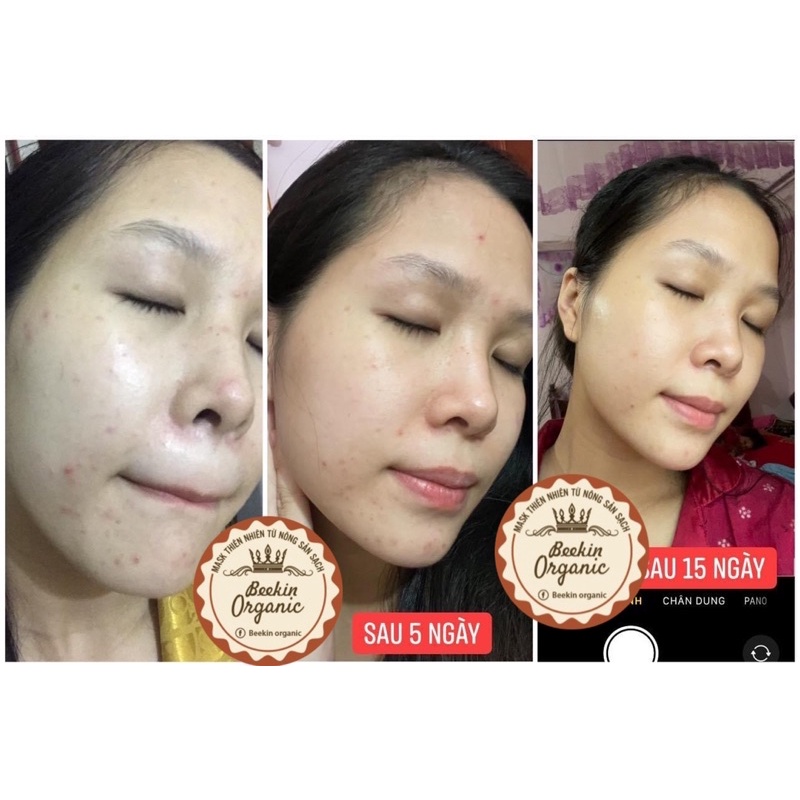 Mặt nạ sữa ong chúa tươi