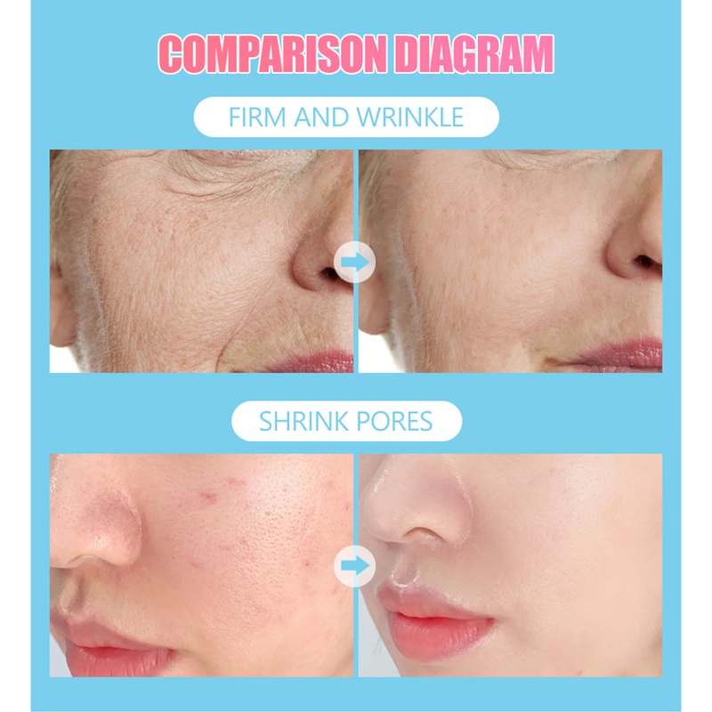 Mặt Nạ Collagen Dưỡng Ẩm Làm Sáng Da Mặt YOUYO