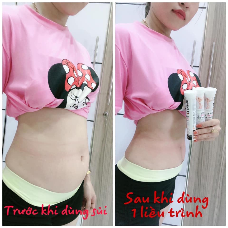 Viên Sủi Hỗ Trợ Giảm Cân ZANTIVA Lọ 20 Viên