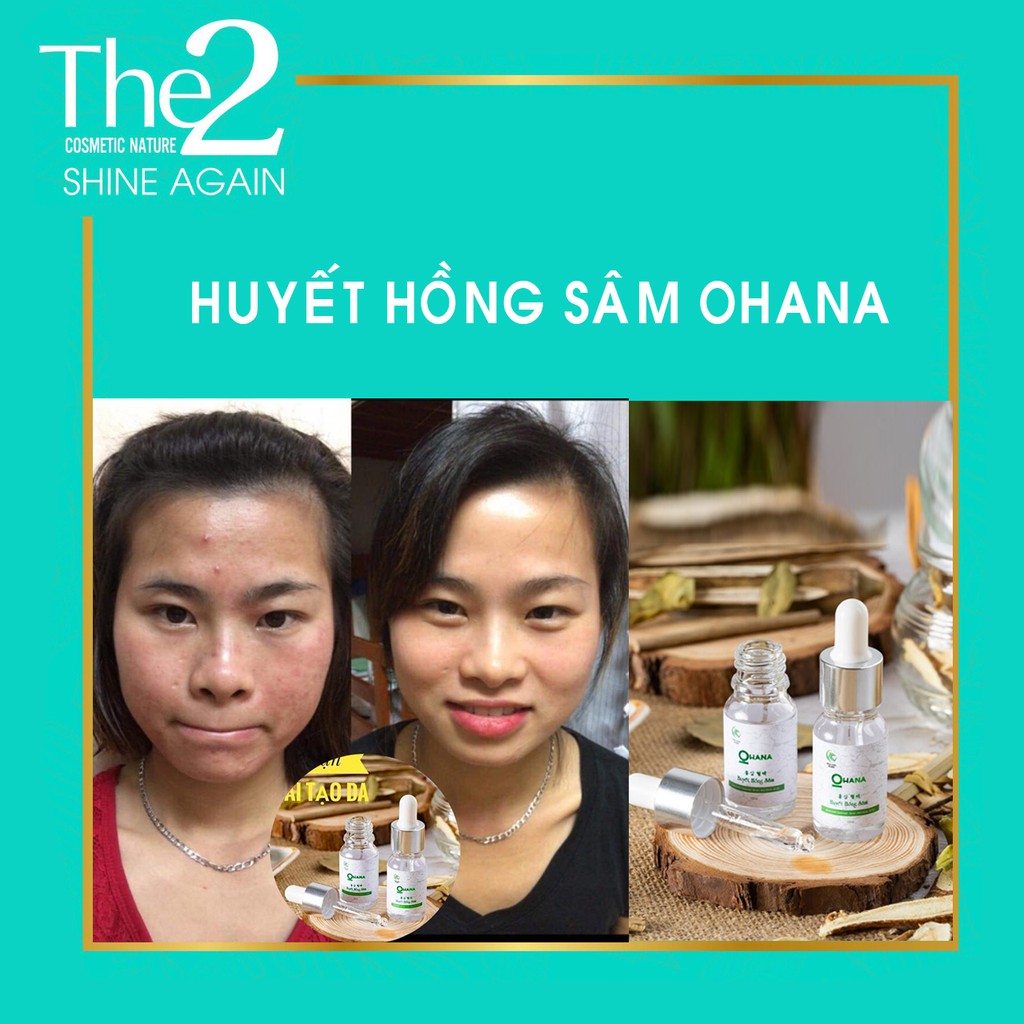 [Chính Hãng] HUYẾT HỒNG SÂM - Đông Y Vũ Đức | BigBuy360 - bigbuy360.vn