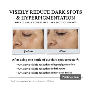 ☯ Tinh Chất Serum Làm Sáng Da & Mờ Thâm Mụn Clearly Corrective™ Dark Spot Solution ☯ Size 50 ml ☯