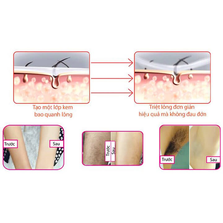 Kem tẩy lông Veet của Pháp 100ml | BigBuy360 - bigbuy360.vn