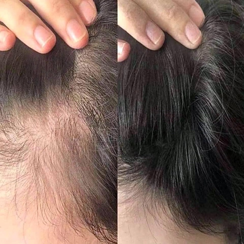 TINH CHẤT THẢO DƯỢC KÍCH MỌC TÓC SANTO- JG sản phẩm của công ty dược tại Nhật - nội địa Nhật Bản