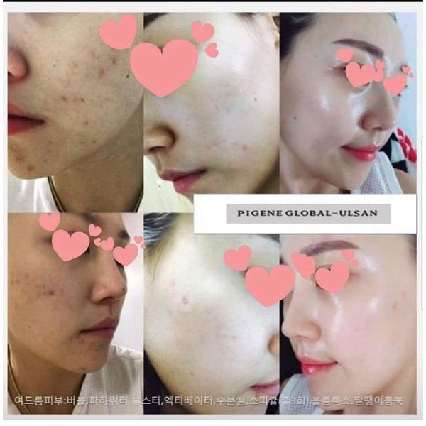 TINH CHẤT CĂNG BÓNG VOLUME TOX ORIGINAL PION-TECH