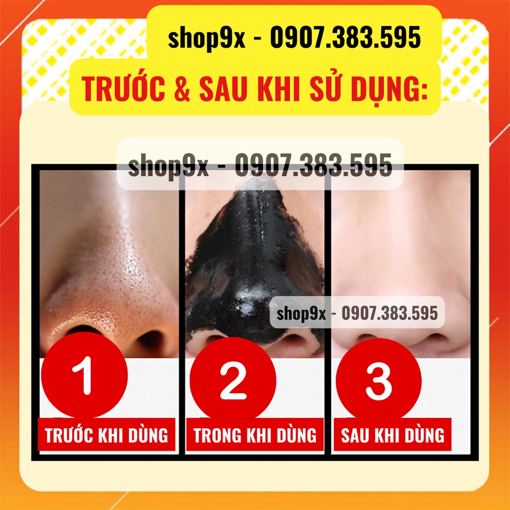 Mặt Nạ Hút Mụn Than Tre - Trắng Da Sạch Mụn