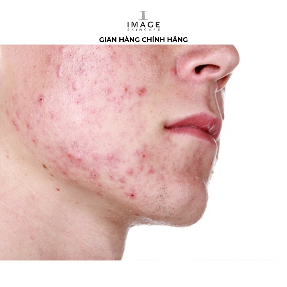 [Mã FMCGMALL -8% đơn 250K] Lotion ngừa mụn Image Skincare Clear Cell Medicated Acne Lotion 7.4 ml | BigBuy360 - bigbuy360.vn