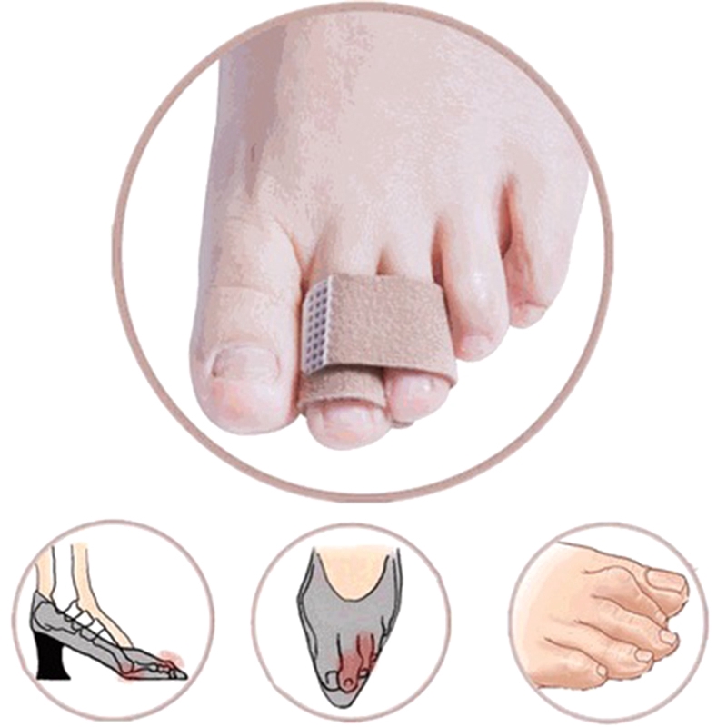 [Hàng mới về] Băng quấn tách ngón chân hỗ trợ chỉnh hình cao cấp tiện dụng