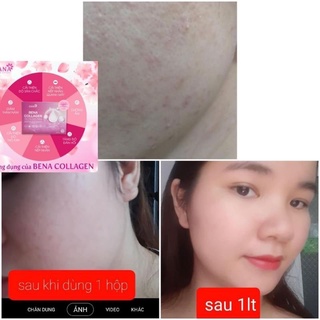 [CAM KẾT CHÍNH HÃNG] Bena Collagen Gana full hộp (hộp 30 gói)