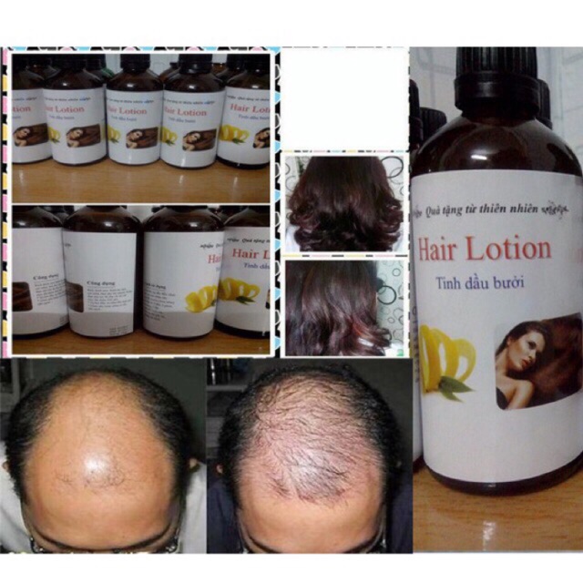 Tinh dầu bưởi kích thích mọc tóc