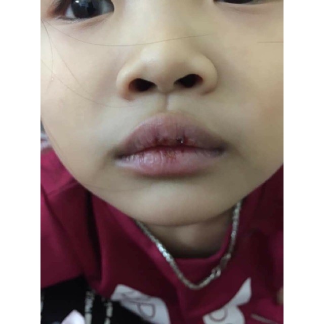 Combo 2 Mặt Nạ Môi Ủ Môi Ủ Hồng Dưỡng Môi . mới làm đẹp từ thiên nhiên, cam kết hàng chính hãng | BigBuy360 - bigbuy360.vn