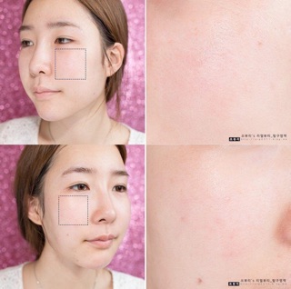 Toner của Nhật