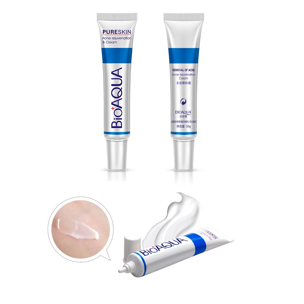 SET ngừa mụn Pure Skin Bioaqua (4 món) | BigBuy360 - bigbuy360.vn