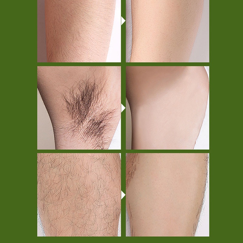 Kem tẩy lông vĩnh viễn thành phần tự nhiên chuyên dụng dành cho nam và nữ