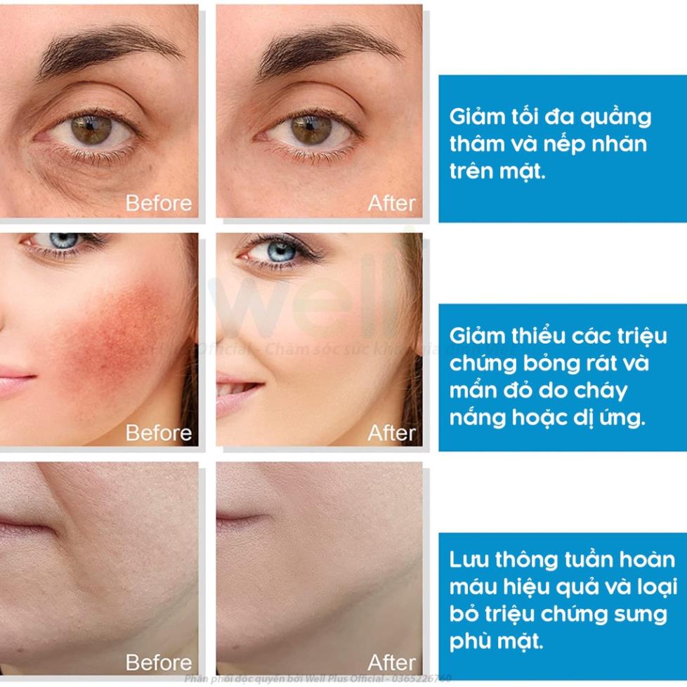 Thanh Lăn Đá Lạnh Massage Mặt Giảm Bọng Mắt Và Thu Nhỏ Lỗ Chân Lông - Quả Cầu Nước