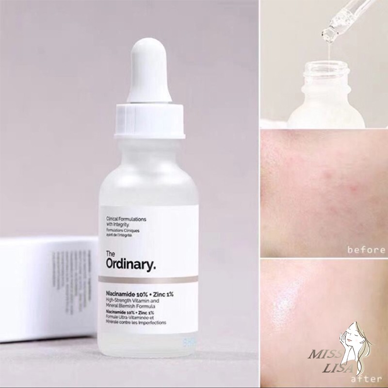 Tinh chất giảm mụn The Ordinary Niacinamide 10% + Zinc 1% 30mL