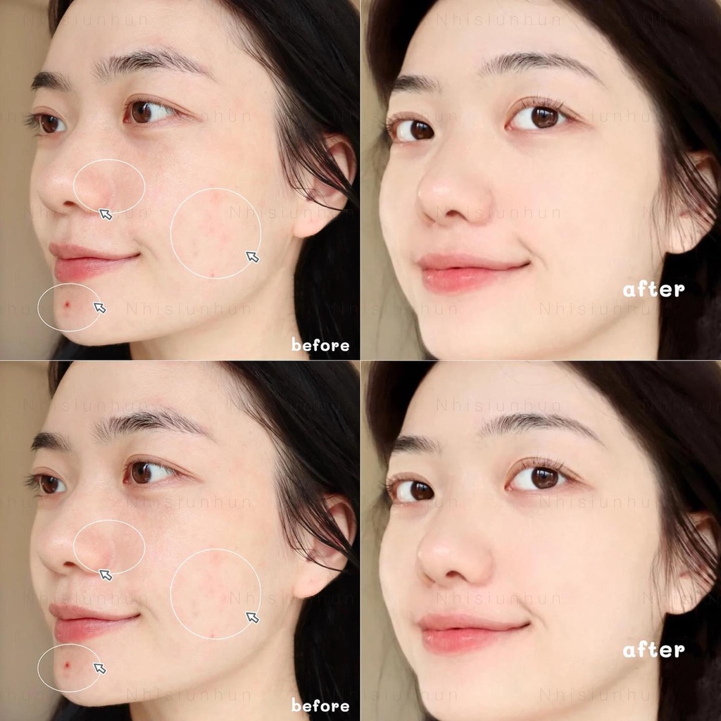 Serum rau má Skin1004 Madagascar Centella Asiatica 100 Ampoule