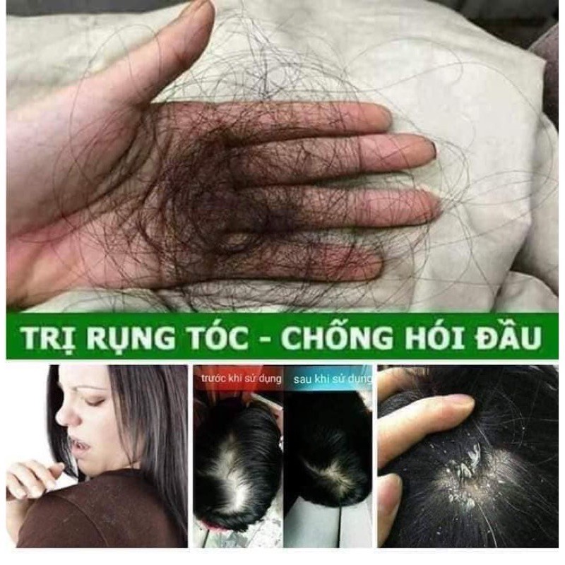 [HÀNG CHÍNH HÃNG] Dầu Gội Thanh Mộc Hương 350g