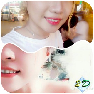 Đá đính răng Thụy Sĩ 2LY (loại nhỏ)