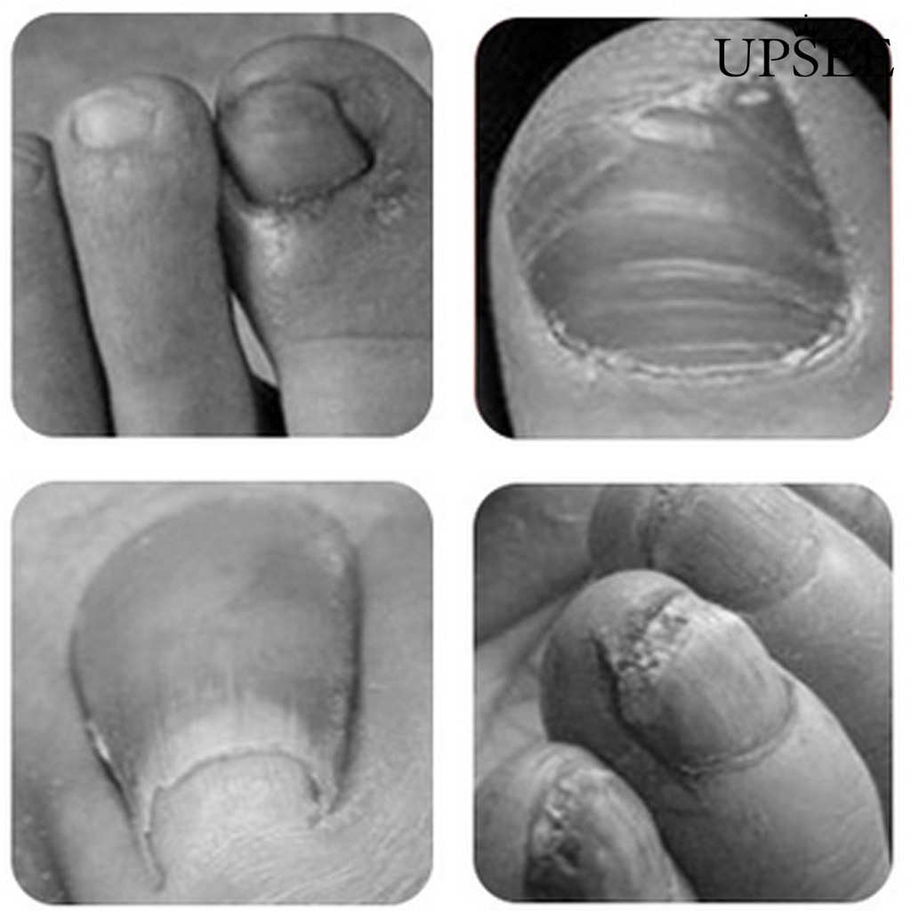 Kéo Cắt Da Chết Mini Bằng Thép Không Gỉ U4-Nail