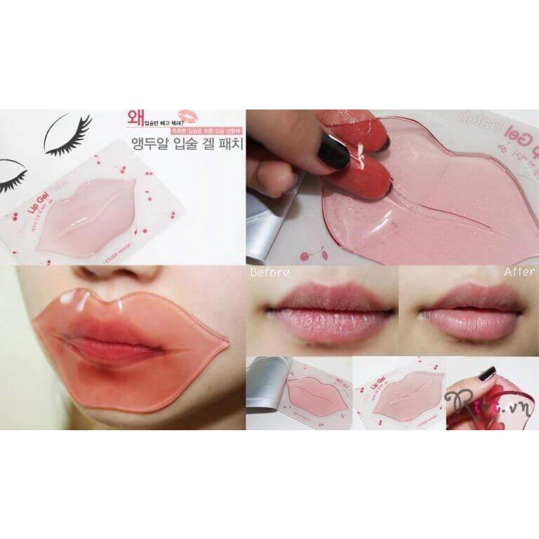 Mặt Nạ Dưỡng Ẩm Hồng Môi ETUDE HOUSE Cherry Jelly Lips Patch (Vitalizing)