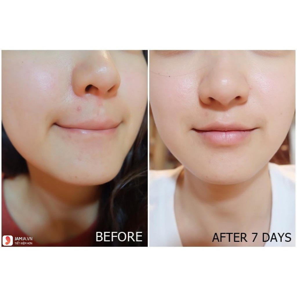 Kem Dưỡng Sáng Da Angel's Liquid 7Day Whitening Program Glutathione 700 V-Cream 50ml