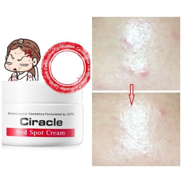 Kem Mụn Và Giảm Thâm Ciracle Red Spot Cream | BigBuy360 - bigbuy360.vn