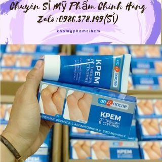 Kem trị nứt gót chân Nga Kpem